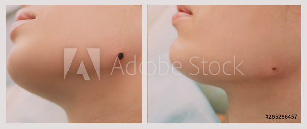 Before & After Photos Before & After Photos